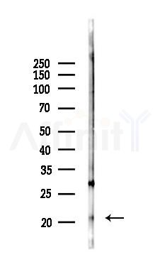 DSTN Antibody - Western blot analysis of lysates from MCF7 cells(heat-shock,45min treatment), using DSTN Antibody at 1/1000 dilution.