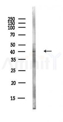 LMAN2 Antibody - Western blot analysis of lysates from EC304 cells(heat-shock,45min treatment), using LMAN2 Antibody at 1/1000 dilution.