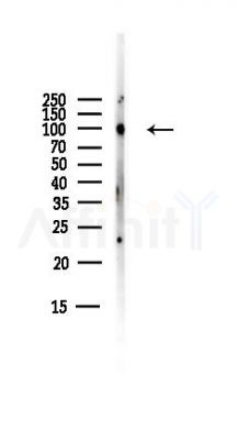 SCYL1 Antibody - Western blot analysis of lysates from B16F10-LUC cells(starvation,24h treatment), using SCYL1 Antibody at 1/1000 dilution.