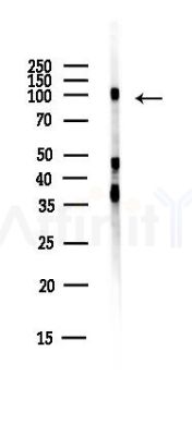 SCYL1 Antibody - Western blot analysis of lysates from EC304 cells(heat-shock,45min treatment), using SCYL1 Antibody at 1/1000 dilution.