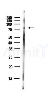 EPB41L5 Antibody - Western blot analysis of lysates from EC304 cells(heat-shock,45min treatment), using EPB41L5 Antibody at 1/1000 dilution.