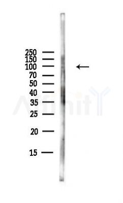 PRICKLE1 Antibody - Western blot analysis of lysates from B16F10-LUC cells(starvation,24h treatment), using PRICKLE1 Antibody at 1/1000 dilution.