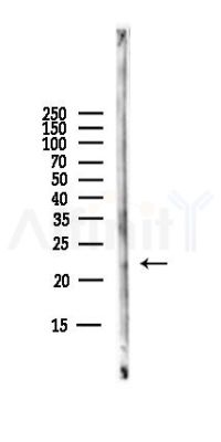 PABPC1L2A; PABPC1L2B Antibody - Western blot analysis of lysates from B16F10-LUC cells(starvation,24h treatment), using PABPC1L2A; PABPC1L2B Antibody at 1/1000 dilution.