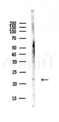 PABPC1L2A; PABPC1L2B Antibody - Western blot analysis of lysates from EC304 cells(heat-shock,45min treatment), using PABPC1L2A; PABPC1L2B Antibody at 1/1000 dilution.