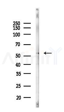GHDC Antibody - Western blot analysis of lysates from Rat liver, using GHDC Antibody at 1/1000 dilution.