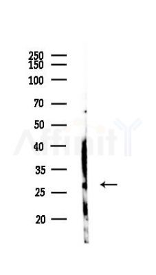 MYCT1 Antibody - Western blot analysis of lysates from Mouse liver, using MYCT1 Antibody at 1/1000 dilution.