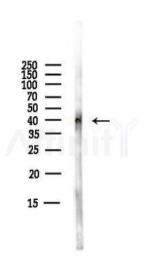 C4orf17 Antibody - Western blot analysis of lysates from B16F10-LUC cells(starvation,24h treatment), using C4orf17 Antibody at 1/1000 dilution.