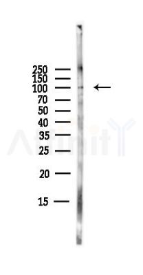 ENPP2 Antibody - Western blot analysis of lysates from B16F10-LUC cells(starvation,24h treatment), using ENPP2 Antibody at 1/1000 dilution.