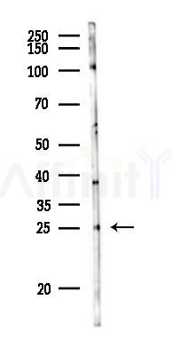 CFC1 Antibody - Western blot analysis of lysates from Rat liver, using CFC1 Antibody at 1/1000 dilution.