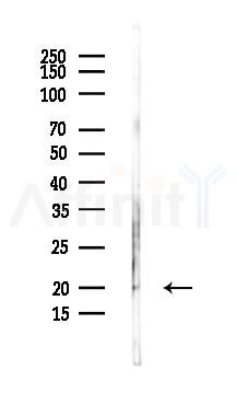 TPPP3 Antibody - Western blot analysis of lysates from Rat brain, using TPPP3 Antibody at 1/1000 dilution.