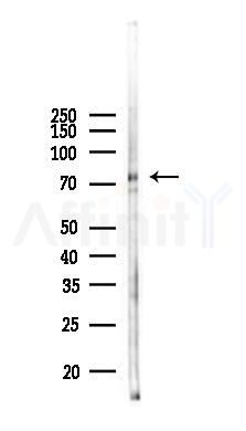 COLGALT1 Antibody - Western blot analysis of lysates from LoVo cells(heat-shock,45min treatment), using COLGALT1 Antibody at 1/1000 dilution.