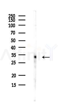 TIMMDC1 Antibody - Western blot analysis of lysates from PC12 cells(heat-shock,45min treatment), using TIMMDC1 Antibody at 1/1000 dilution.