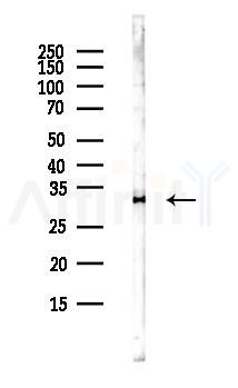 TIMMDC1 Antibody - Western blot analysis of lysates from Hela cells(UV,30min treatment), using TIMMDC1 Antibody at 1/1000 dilution.
