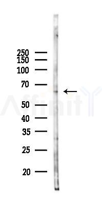 ZNF449 Antibody - Western blot analysis of lysates from LoVo cells(heat-shock,45min treatment), using ZNF449 Antibody at 1/1000 dilution.