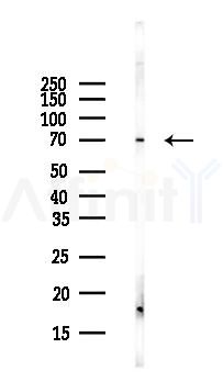 MOXD1 Antibody - Western blot analysis of lysates from Hela cells(UV,30min treatment), using MOXD1 Antibody at 1/1000 dilution.