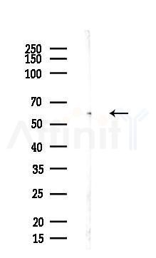 NTNG1 Antibody - Western blot analysis of lysates from Mouse lung, using NTNG1 Antibody at 1/1000 dilution.
