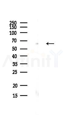 SNW1 Antibody - Western blot analysis of lysates from PC12 cells(heat-shock,45min treatment), using SNW1 Antibody at 1/1000 dilution.