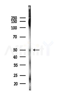 SCML4 Antibody - Western blot analysis of lysates from Rat liver, using SCML4 Antibody at 1/1000 dilution.
