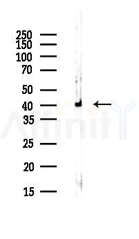 GMPPB Antibody - Western blot analysis of lysates from Hela cells(UV,30min treatment), using GMPPB Antibody at 1/1000 dilution.