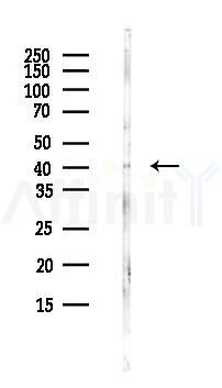 TMOD3 Antibody - Western blot analysis of lysates from Hela cells(UV,30min treatment), using TMOD3 Antibody at 1/1000 dilution.