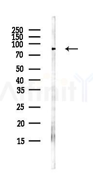 HOOK2 Antibody - Western blot analysis of lysates from Hela cells(UV,30min treatment), using HOOK2 Antibody at 1/1000 dilution.