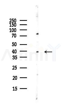 KLF3 Antibody - Western blot analysis of lysates from Hela cells(UV,30min treatment), using KLF3 Antibody at 1/1000 dilution.