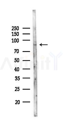 SPG7 Antibody - Western blot analysis of lysates from MCF7 cells(heat-shock,45min treatment), using SPG7 Antibody at 1/1000 dilution.