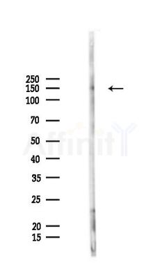 TNKS2 Antibody - Western blot analysis of lysates from HepG2 cells(LPS,4h treatment), using TNKS2 Antibody at 1/1000 dilution.