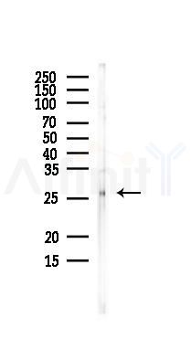 CHMP4C Antibody - Western blot analysis of lysates from EC304 cells, using CHMP4C Antibody at 1/1000 dilution.
