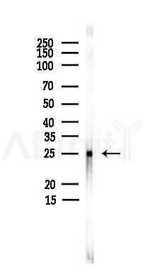 CHMP4C Antibody - Western blot analysis of lysates from PC12 cells(heat-shock,45min treatment), using CHMP4C Antibody at 1/1000 dilution.