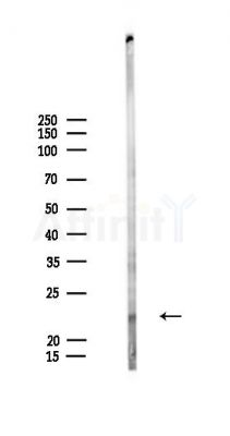 LIN7B Antibody - Western blot analysis of lysates from HepG2 cells(LPS,4h treatment), using LIN7B Antibody at 1/1000 dilution.