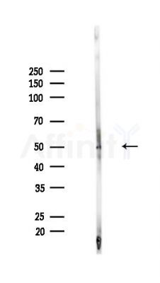 GLUD2 Antibody - Western blot analysis of lysates from Mouse lung, using GLUD2 Antibody at 1/1000 dilution.