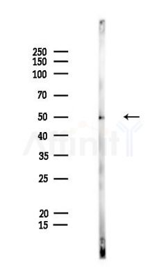 GLUD2 Antibody - Western blot analysis of lysates from PC12 cells, using GLUD2 Antibody at 1/1000 dilution.