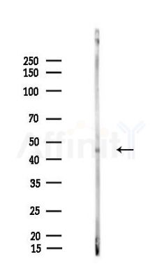 GLUD2 Antibody - Western blot analysis of lysates from LoVo cells(heat-shock,45min treatment), using GLUD2 Antibody at 1/1000 dilution.