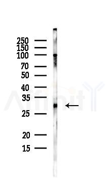 SNRPA1 Antibody - Western blot analysis of lysates from EC304 cells, using SNRPA1 Antibody at 1/1000 dilution.