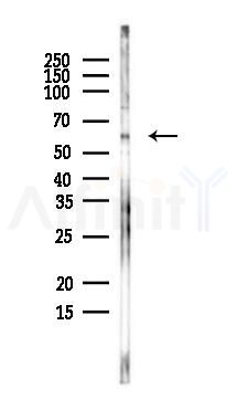FEZ1 Antibody - Western blot analysis of lysates from EC304 cells, using FEZ1 Antibody at 1/1000 dilution.