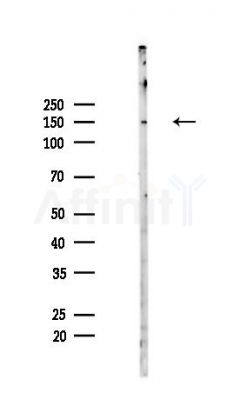 ZNF423 Antibody - Western blot analysis of lysates from Mouse lung, using ZNF423 Antibody at 1/1000 dilution.