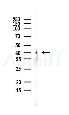 MBNL2 Antibody - Western blot analysis of lysates from EC304 cells, using MBNL2 Antibody at 1/1000 dilution.