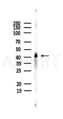 MBNL2 Antibody - Western blot analysis of lysates from PC12 cells(heat-shock,45min treatment), using MBNL2 Antibody at 1/1000 dilution.
