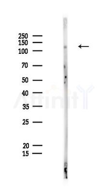 JARID2 Antibody - Western blot analysis of lysates from PC12 cells, using JARID2 Antibody at 1/1000 dilution.