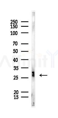 MED19 Antibody - Western blot analysis of lysates from A375 cells, using MED19 Antibody at 1/1000 dilution.