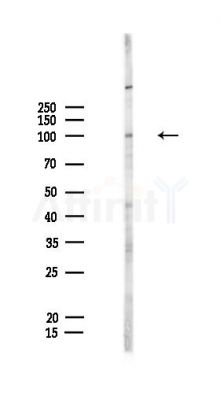 MYSM1 Antibody - Western blot analysis of lysates from HepG2 cells(LPS,4h treatment), using MYSM1 Antibody at 1/1000 dilution.