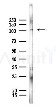 FBXO11 Antibody - Western blot analysis of lysates from A375 cells, using FBXO11 Antibody at 1/1000 dilution.