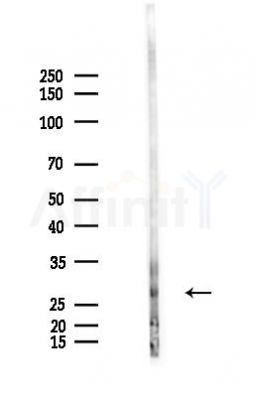CCDC124 Antibody - Western blot analysis of lysates from LoVo cells(heat-shock,45min treatment), using CCDC124 Antibody at 1/1000 dilution.