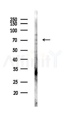 PUS10 Antibody - Western blot analysis of lysates from Hela cells(LPS,4h treatment), using PUS10 Antibody at 1/1000 dilution.