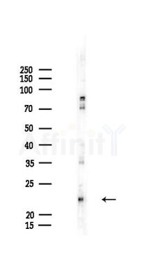 EMC4 Antibody - Western blot analysis of lysates from HepG2 cells(LPS,4h treatment), using EMC4 Antibody at 1/1000 dilution.