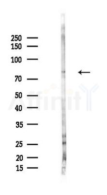 TRMT1 Antibody - Western blot analysis of lysates from LoVo cells(heat-shock,45min treatment), using TRMT1 Antibody at 1/1000 dilution.