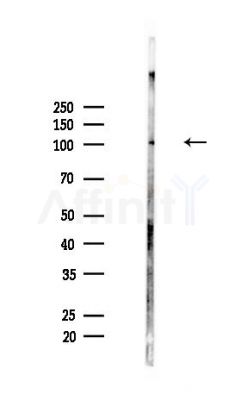 ABR Antibody - Western blot analysis of lysates from Mouse lung, using ABR Antibody at 1/1000 dilution.