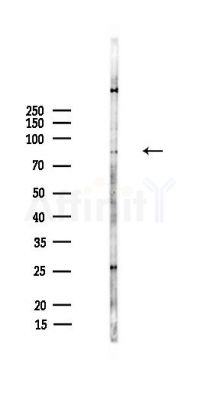 ABR Antibody - Western blot analysis of lysates from HepG2 cells(LPS,4h treatment), using ABR Antibody at 1/1000 dilution.