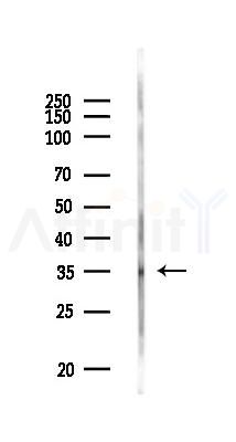 TSPY1 Antibody - Western blot analysis of lysates from PC12 cells, using TSPY1 Antibody at 1/1000 dilution.